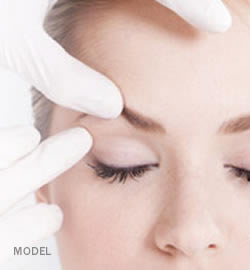 eyelid-surgery-lift-before-wedding